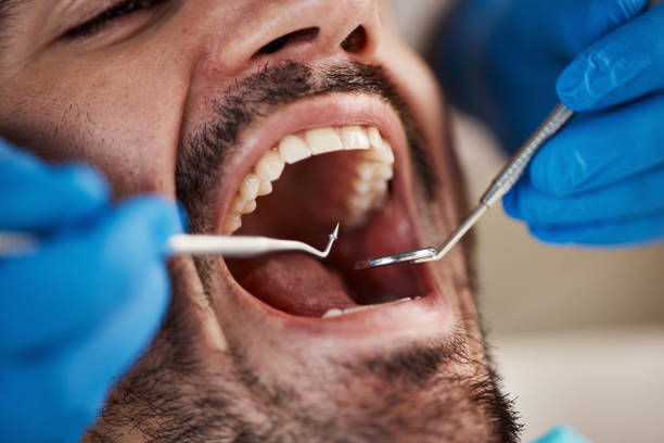 Best Emergency Gum Treatment in North River Shores, FL