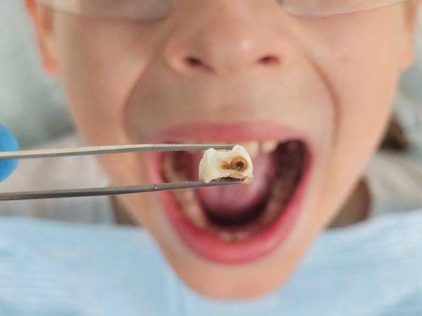 Best Weekend Emergency Dentist in North River Shores, FL